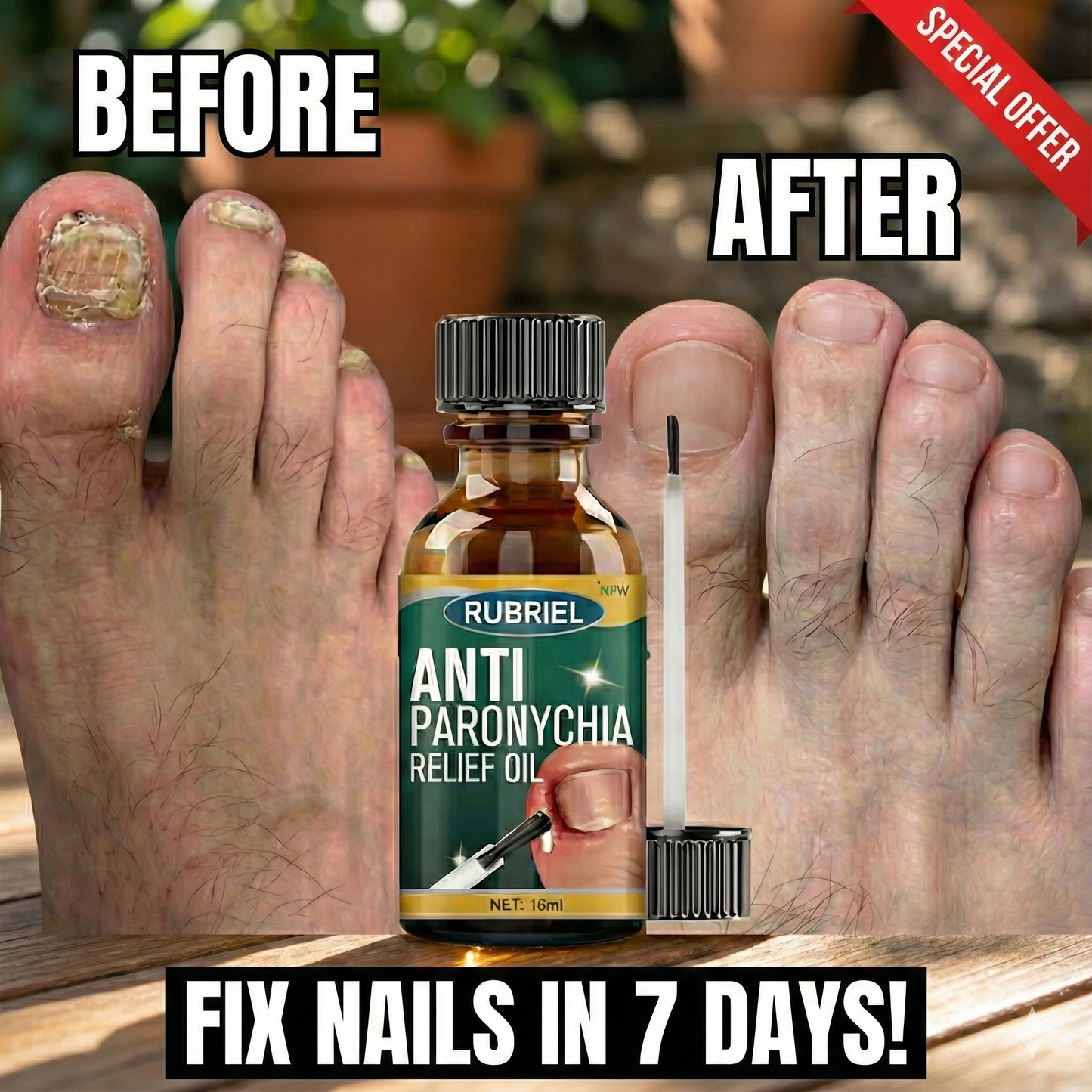 Anti Paronychia Relief Oil - Buy 1 Get 1 FREE🔥