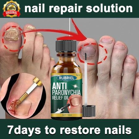 Anti Paronychia Relief Oil - Buy 1 Get 1 FREE🔥