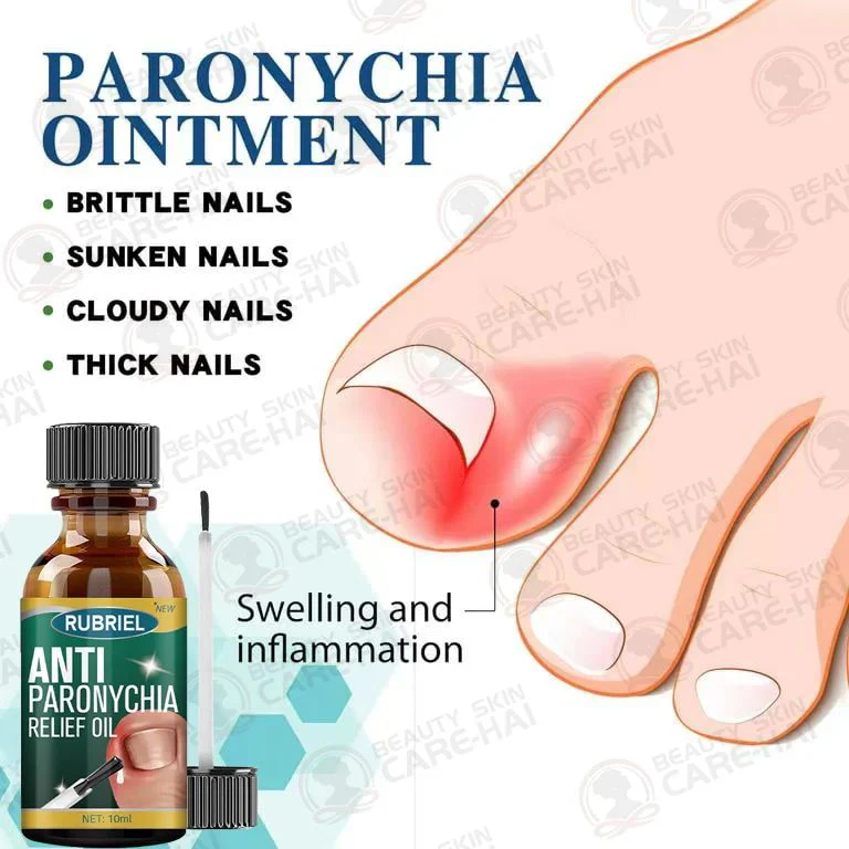 Anti Paronychia Relief Oil - Buy 1 Get 1 FREE🔥