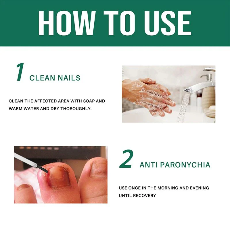 Anti Paronychia Relief Oil - Buy 1 Get 1 FREE🔥