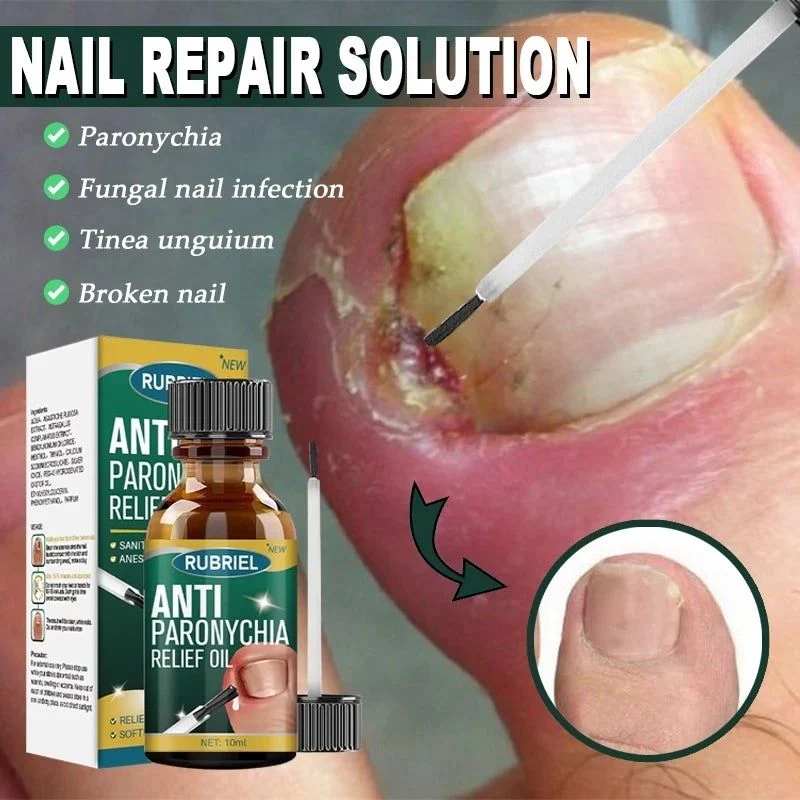 Anti Paronychia Relief Oil - Buy 1 Get 1 FREE🔥